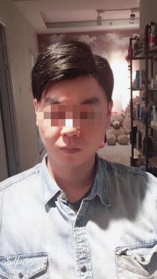 补发后正面效果