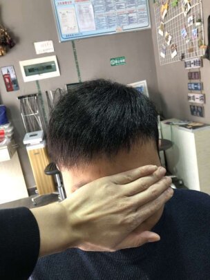补发后正面效果