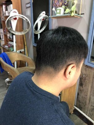 补发后背面效果
