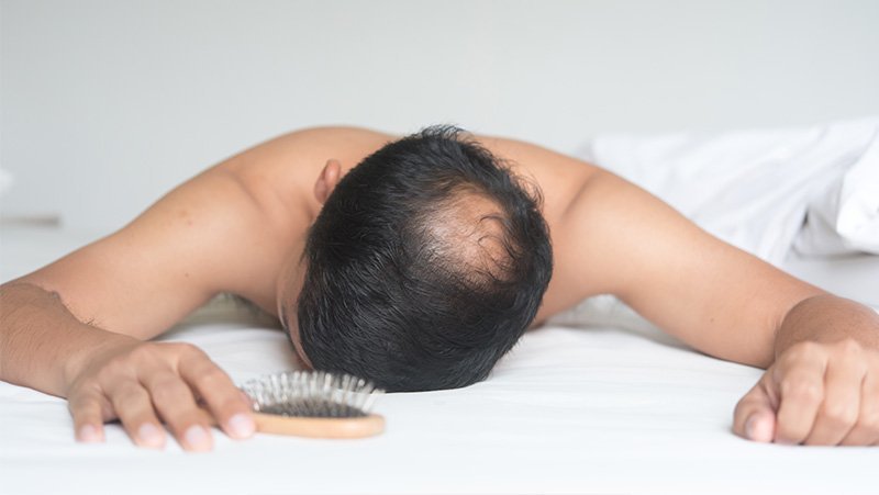 男士秃顶用假发效果好吗？