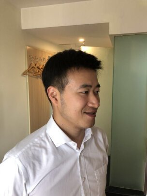 假发补发后效果 假发补发后效果
