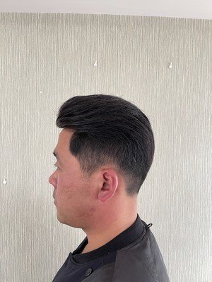 补发后侧面效果