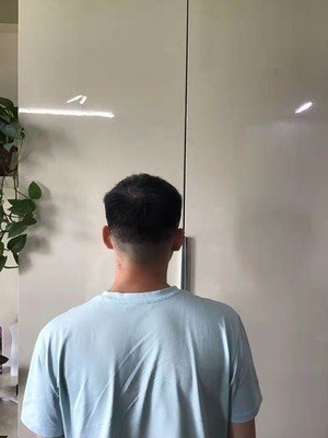 补发前背面效果 补发前背面效果