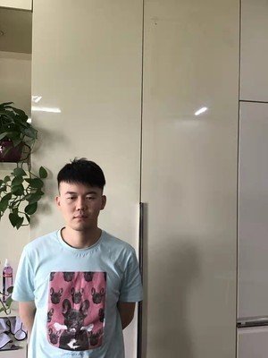 补发后发型帅气 补发后发型帅气