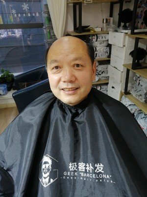 补发前秃顶老气 补发前秃顶老气