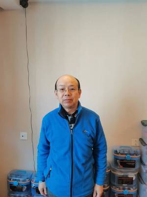 严重脱发秃顶——正面 严重脱发秃顶——正面