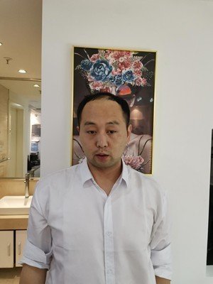 补发前正面效果 补发前正面效果