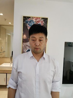 补发后正面效果 补发后正面效果