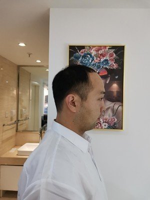 补发前侧面效果 补发前侧面效果