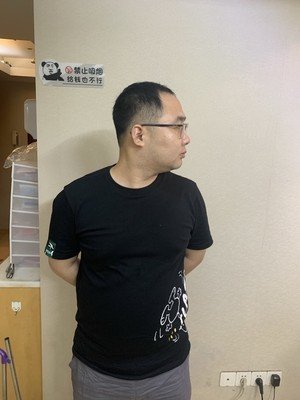 补发前侧面效果 补发前侧面效果