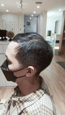 补发前侧面效果 补发前侧面效果
