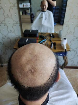 补发前背面图效果 补发前背面图效果