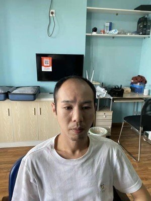 发际线高 发际线高