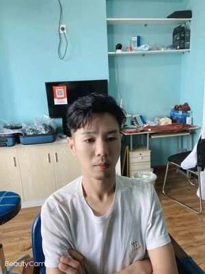 补发后年轻帅气 补发后年轻帅气