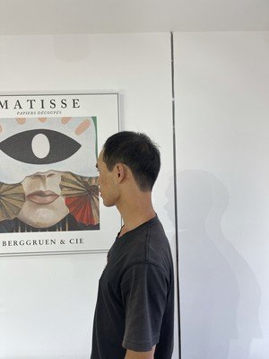 补发前侧面效果 补发前侧面效果
