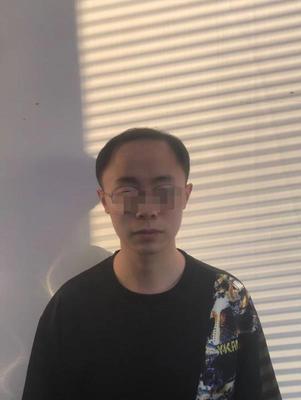补发前额头发际线高 补发前额头发际线高