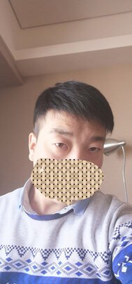 补发后效果——正面 补发后效果——正面