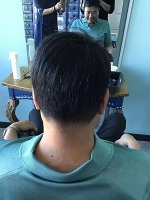 补发后背面效果 补发后背面效果
