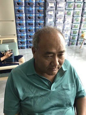 补发前秃顶、白发:正面 补发前秃顶、白发:正面