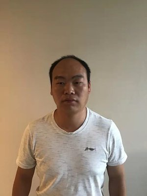 补发前正面效果 补发前正面效果