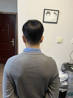 补发后背面效果 补发后背面效果