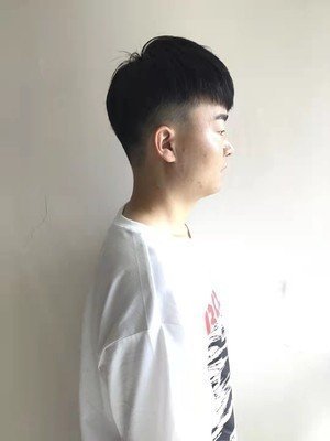 补发后侧面效果