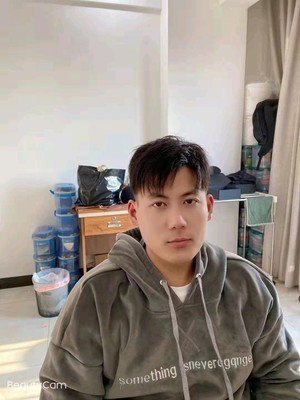 头发稀少,织发补发后效果 头发稀少,织发补发后效果