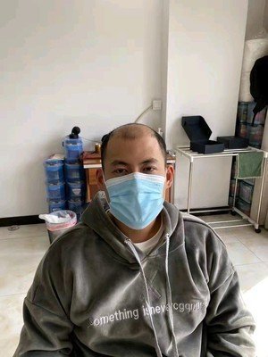 头发少 头发少