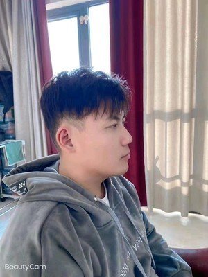 补发后侧面效果