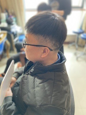 补发后侧面效果
