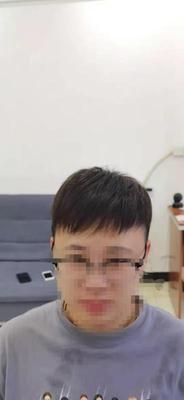 补发后效果 补发后效果