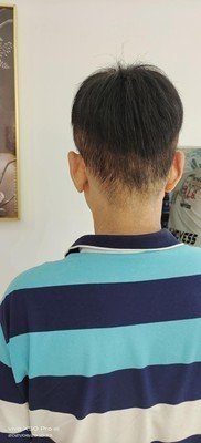 补发后背面效果 补发后背面效果