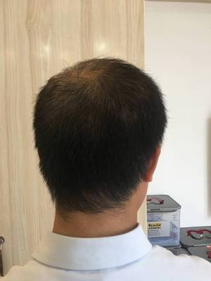 补发前背面效果 补发前背面效果