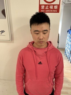 补发后正面效果 补发后正面效果