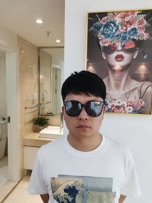 补发后正面效果:年轻帅气 补发后正面效果:年轻帅气