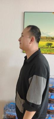 补发后侧面效果 补发后侧面效果