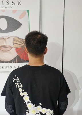 补发后背面效果 补发后背面效果