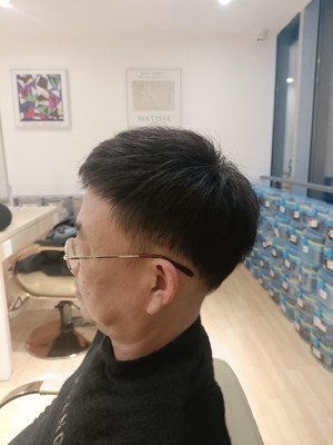 补发后侧面效果