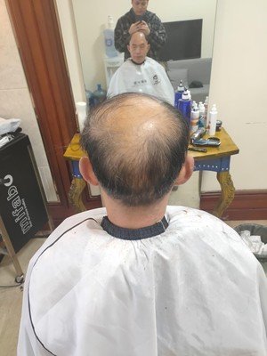 补发前背面效果 补发前背面效果