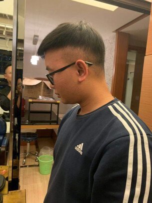 补发后侧面效果 补发后侧面效果