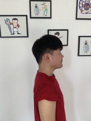 补发后侧面效果