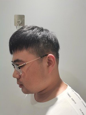 补发后侧面效果