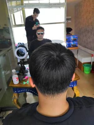 补发后背面效果