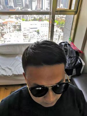 补发后正面效果