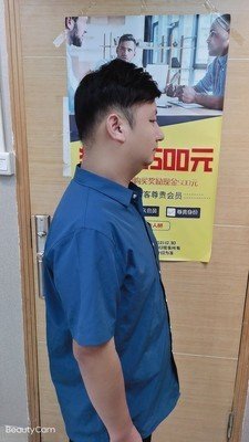 补发后右侧面效果
