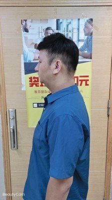 补发后左侧面效果