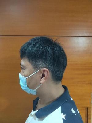 补发后左侧面效果 补发后左侧面效果