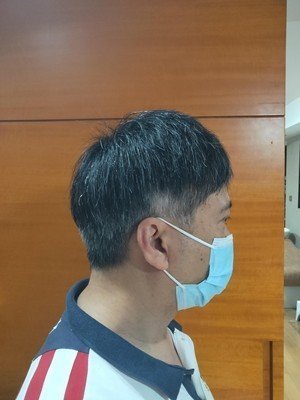 补发后右侧面效果 补发后右侧面效果
