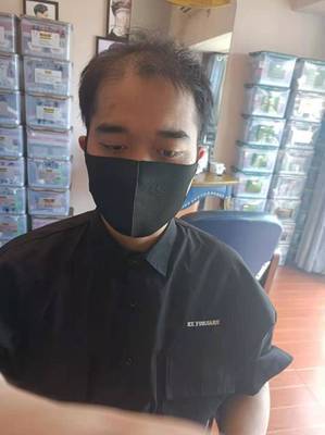 补发前头发稀少:正面 补发前头发稀少:正面