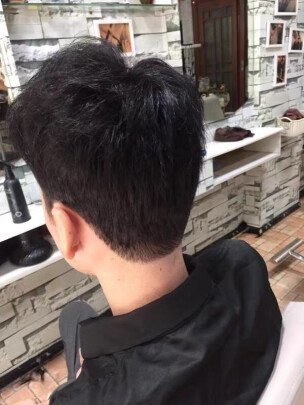 补发后头发浓密 补发后头发浓密